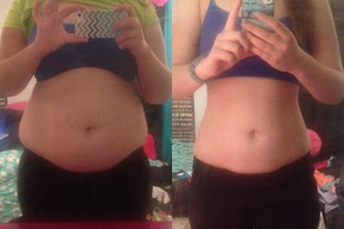 Weight Loss